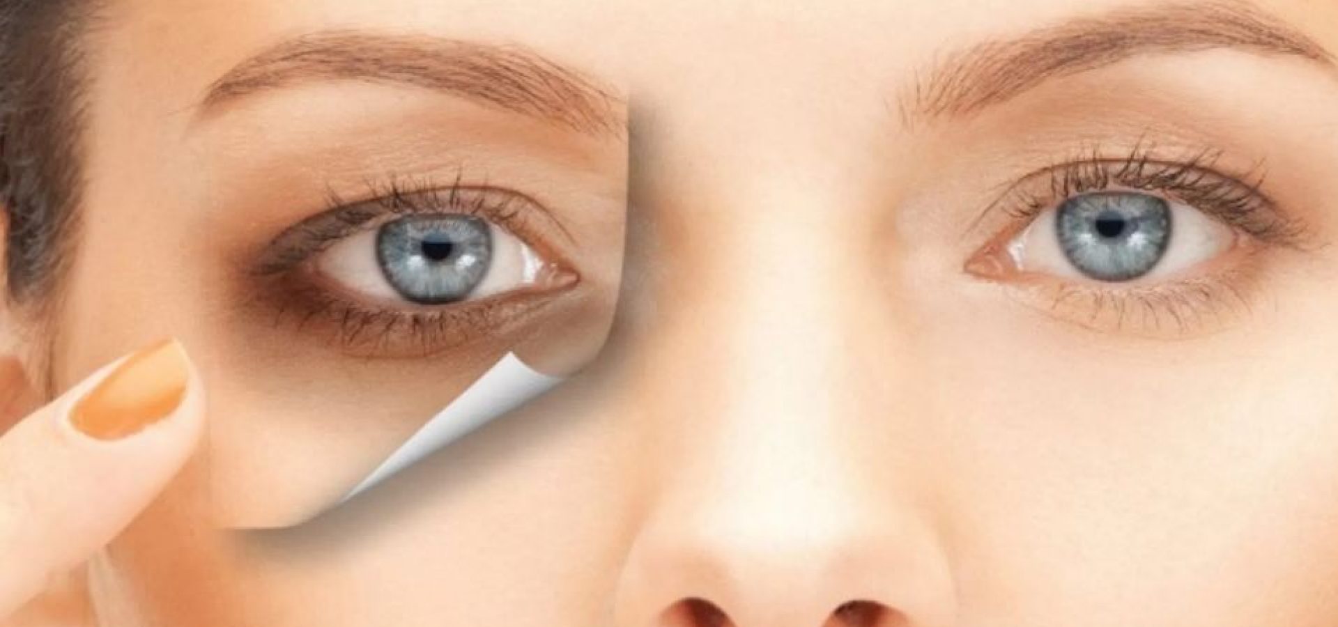 Göz Altı Morlukları Neden Olur?