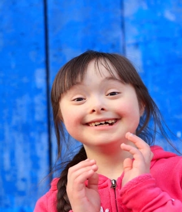 Down Sendromu Belirtileri